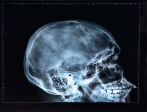 Human Skull Found on Airplane
